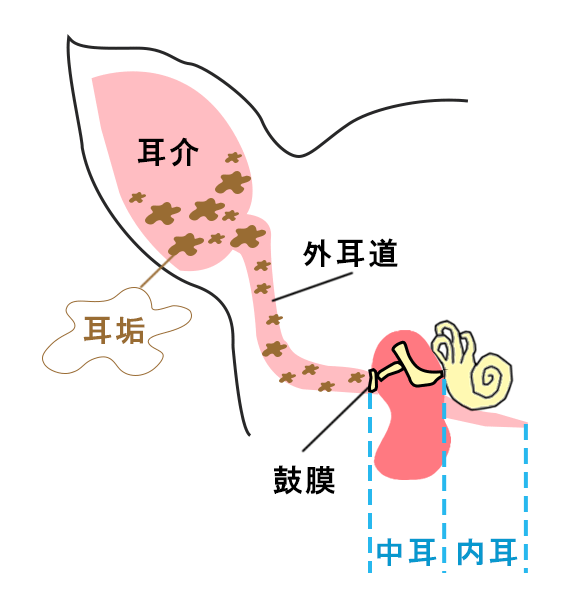 外耳炎 外耳炎
